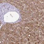 Anti-GK Antibody