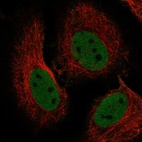 Anti-RBBP4 Antibody