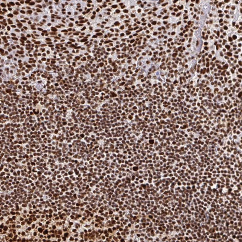 Anti-RBBP4 Antibody