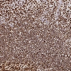 Anti-RBBP4 Antibody