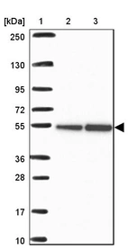 Lane 1: Marker [kDa] 250, 130, 95, 72, 55, 36, 28, 17, 10_br/_Lane 2: Human cell line RT-4_br/_Lane 3: Human cell line U-251 MG