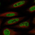 Immunofluorescence staining in HeLa cell line with Anti-SMARCA4 monoclonal antibody, showing specific staining of nucleoplasm and nuclear bodies in green. Microtubule- and nuclear probes are visualized in red and blue respectively (where available).