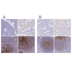 Immunohistochemical staining of human endometrium, kidney, lymph node and tonsil using Anti-CR2 antibody HPA060715 (A) shows similar protein distribution across tissues to independent antibody HPA052942 (B).