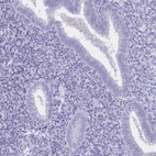 Immunohistochemical staining of human endometrium shows no positivity in glandular cells as expected.