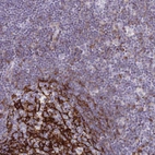 Immunohistochemical staining of human lymph node shows strong membranous positivity in germinal center cells.