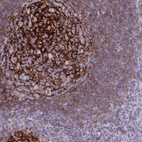 Immunohistochemical staining of human tonsil shows strong membranous positivity in germinal center cells.