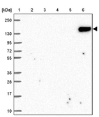 Lane 1: Marker [kDa] 250, 130, 95, 72, 55, 36, 28, 17, 10_br/_Lane 2: Human cell line RT-4_br/_Lane 3: Human cell line U-251 MG_br/_Lane 4: Human plasma_br/_Lane 5: Human Liver tissue_br/_Lane 6: Human Tonsil tissue