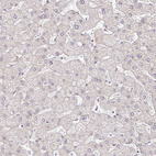 Anti-EHF Antibody