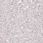 Immunohistochemical staining of human liver shows no positivity in hepatocytes as expected.