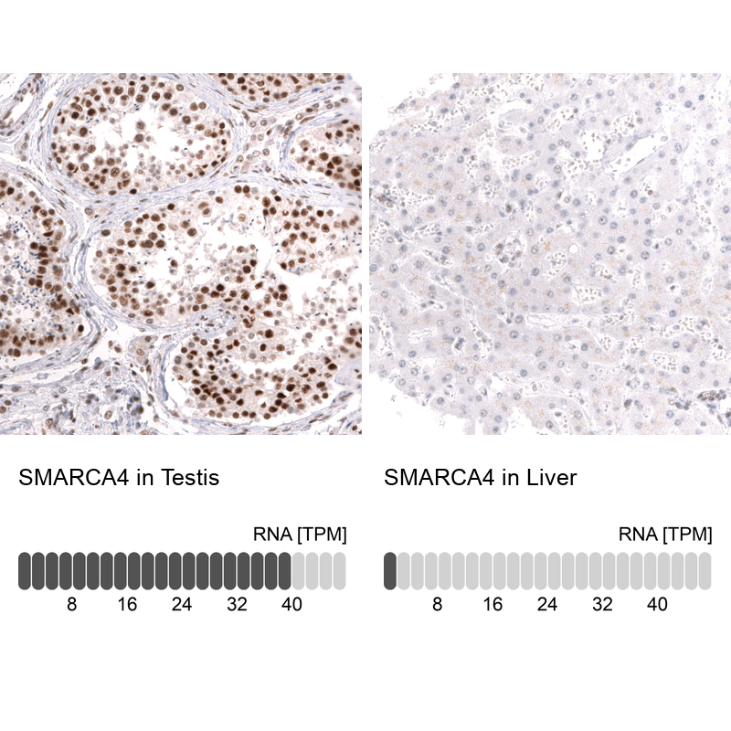 Anti-SMARCA4 Antibody