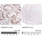 Anti-SMARCA4 Antibody