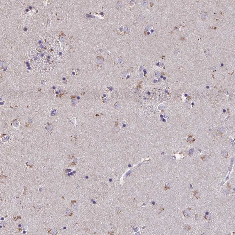 Anti-ZNF34 Antibody
