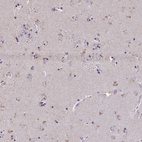 Anti-ZNF34 Antibody