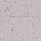 Anti-ZNF34 Antibody