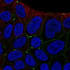 Immunofluorescent staining of human cell line RT4 shows localization to cell junctions.