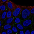 Anti-MPZL2 Antibody