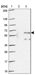 Lane 1: Marker [kDa] 250, 130, 95, 72, 55, 36, 28, 17, 10_br/_Lane 2: Human cell line RT-4_br/_Lane 3: Human cell line U-251MG sp