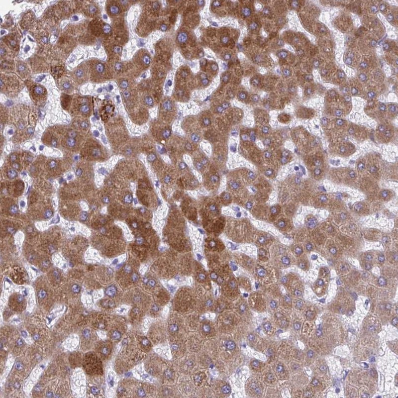 Anti-AIG1 Antibody