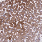 Anti-AIG1 Antibody