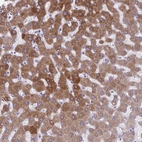 Anti-AIG1 Antibody