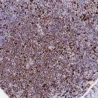 Anti-ZNF586 Antibody