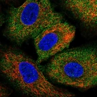 Immunofluorescent staining of human cell line A549 shows localization to cytosol.