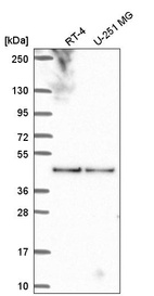 Anti-BORCS6 Antibody