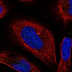 Anti-BORCS6 Antibody