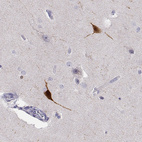 Anti-YJEFN3 Antibody