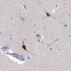 Anti-YJEFN3 Antibody