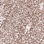 Anti-SMARCA4 Antibody