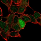 Anti-ID4 Antibody