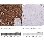 Anti-PLA2G1B Antibody