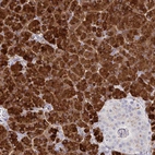 Immunohistochemical staining of human pancreas shows strong cytoplasmic positivity in exocrine glandular cells.