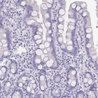 Immunohistochemical staining of human small intestine shows no positivity in glandular cells as expected.