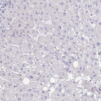 Anti-PLA2G1B Antibody