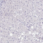 Immunohistochemical staining of human liver shows no positivity in hepatocytes as expected.