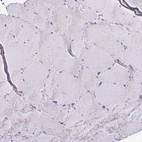 Immunohistochemical staining of human skeletal muscle shows no positivity in myocytes as expected.