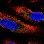 Immunofluorescent staining of human cell line U-2 OS shows localization to cytosol.