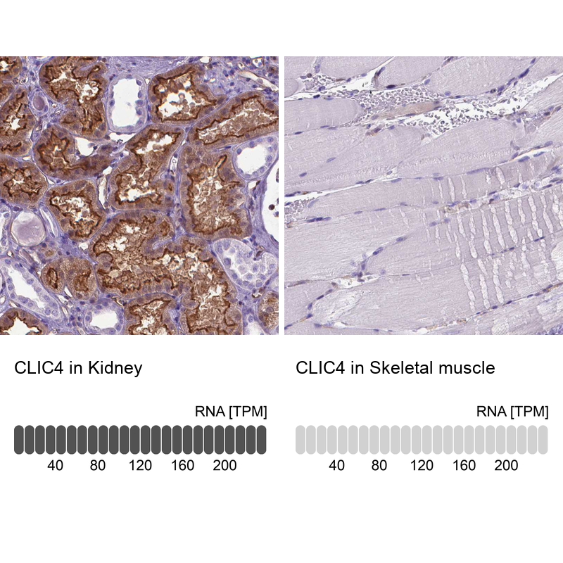 Anti-CLIC4 Antibody