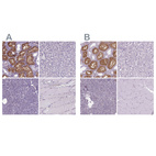 Immunohistochemical staining of human kidney, liver, pancreas and skeletal muscle using Anti-CLIC4 antibody HPA060804 (A) shows similar protein distribution across tissues to independent antibody HPA008019 (B).