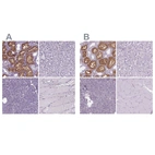 Immunohistochemical staining of human kidney, liver, pancreas and skeletal muscle using Anti-CLIC4 antibody HPA060804 (A) shows similar protein distribution across tissues to independent antibody HPA008019 (B).