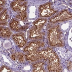 Immunohistochemical staining of human kidney shows strong membranous and cytoplasmic positivity in cells in tubules.