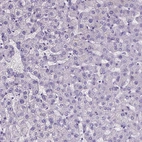 Immunohistochemical staining of human liver shows no positivity in hepatocytes as expected.