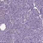 Immunohistochemical staining of human pancreas shows no positivity in exocrine glandular cells as expected.