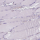 Immunohistochemical staining of human skeletal muscle shows no positivity in myocytes as expected.