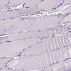 Immunohistochemical staining of human skeletal muscle shows no positivity in myocytes as expected.