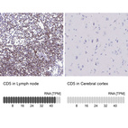 Anti-CD5 Antibody