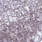 Anti-CD5 Antibody