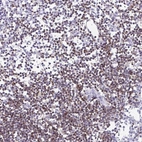Immunohistochemical staining of human lymph node shows high expression.